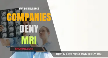 Why Insurance Companies Often Deny MRI Requests: Key Reasons Explained