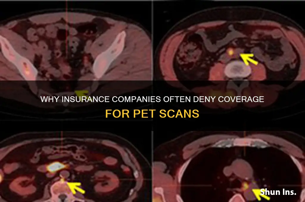 why do insurance companies deny pet scans