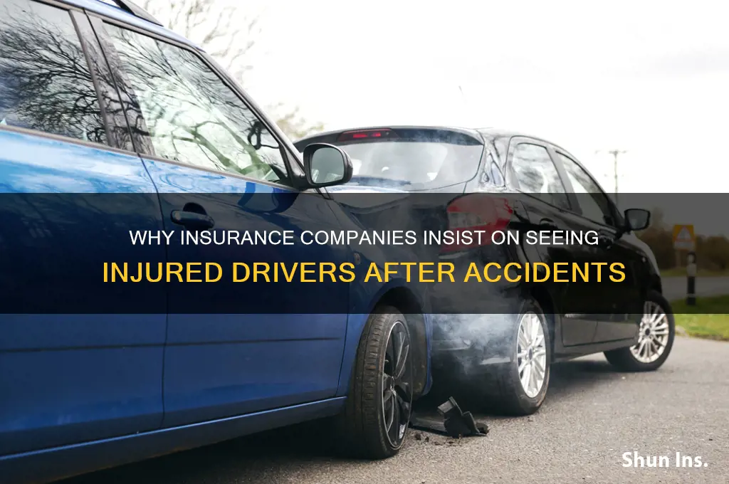 why do insurance companies want to see injured drivers