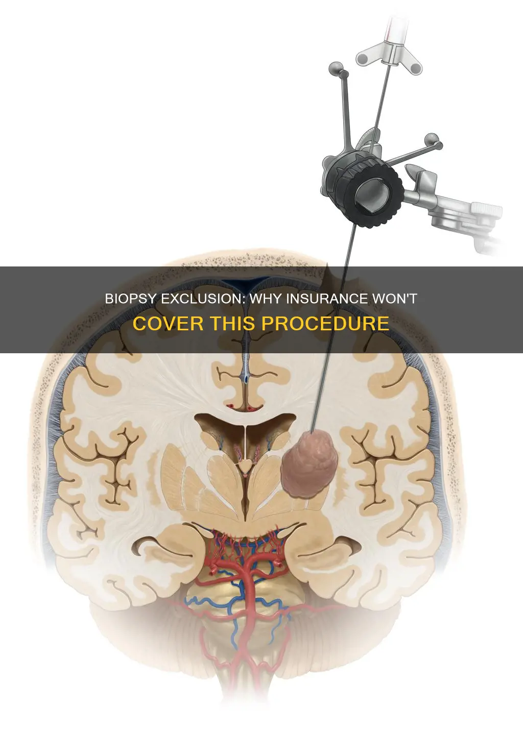 why doesnt medical insurance cover biopsy