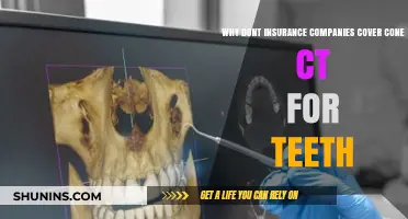 Why Dental Insurance Often Excludes Cone Beam CT Scans for Teeth