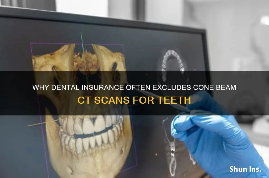 why dont insurance companies cover cone ct for teeth