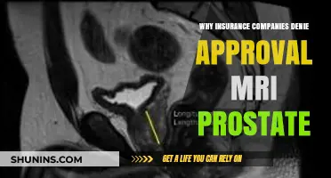 Why Insurance Companies Often Deny MRI Prostate Approvals Explained