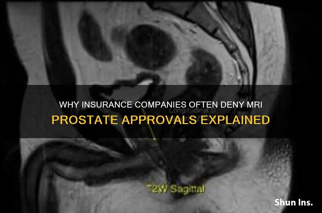 why insurance companies denie approval mri prostate