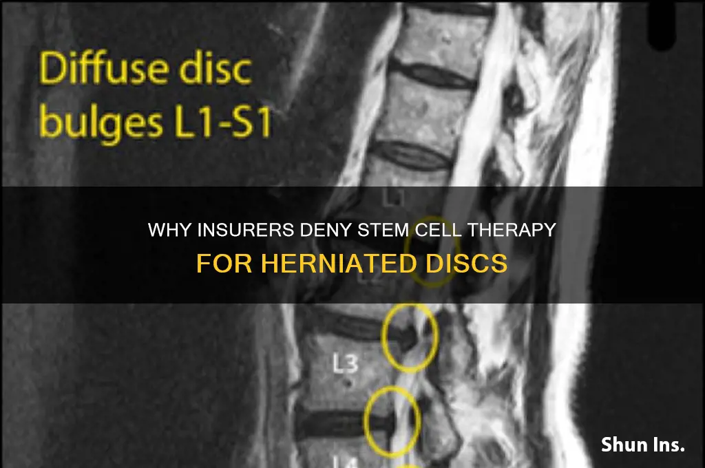 why insurance companies refuse stem cell therapy for herniated disc