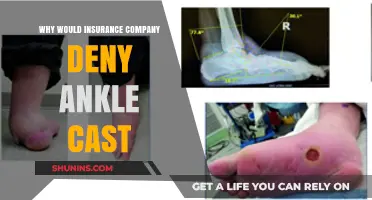 Why Insurance Companies Deny Ankle Cast Claims: Key Reasons Explained
