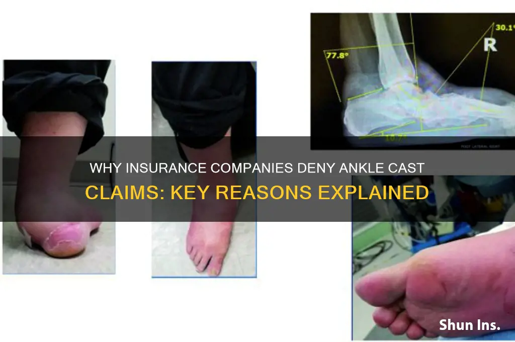 why would insurance company deny ankle cast