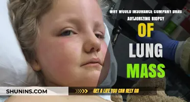 Why Insurance Companies Delay Authorizing Biopsies for Lung Masses