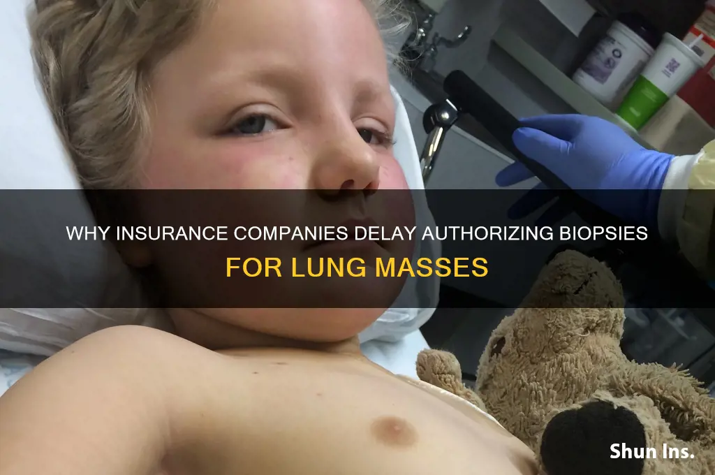 why would insurance company drag autjorizing biopsy of lung mass