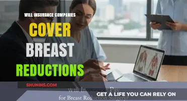Will Insurance Cover Breast Reduction Surgery? What You Need to Know