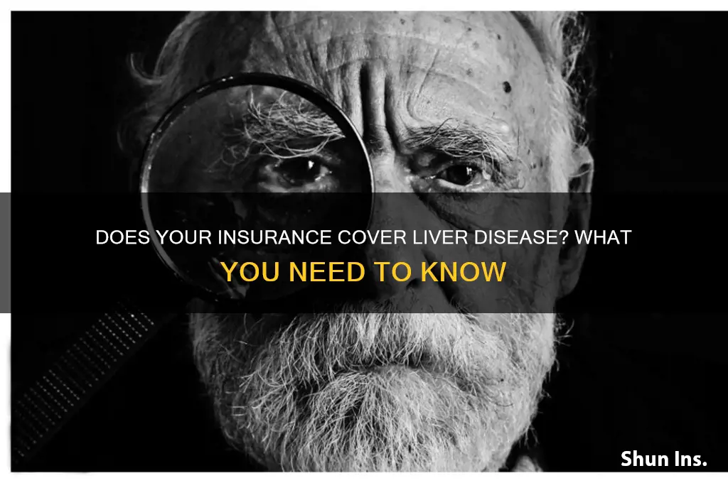will insurance companies cover liver disease