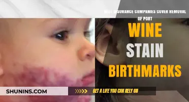 Does Insurance Cover Port Wine Stain Birthmark Removal?