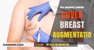 Does Insurance Cover Breast Augmentation? What You Need to Know
