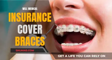 Understanding Medical Insurance Coverage for Braces: What You Need to Know