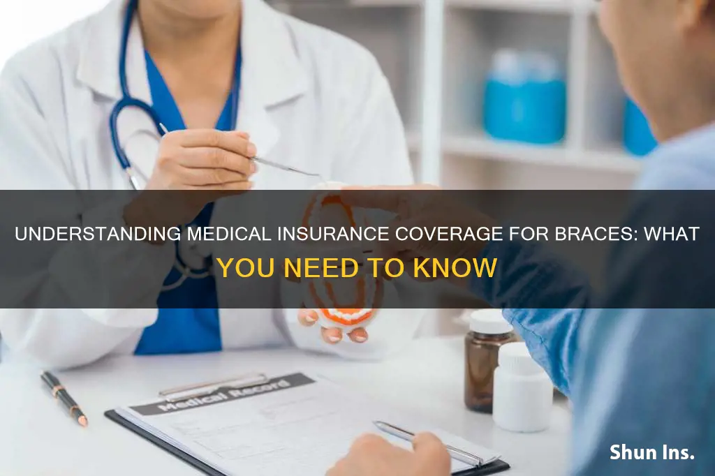 will medical insurance cover braces