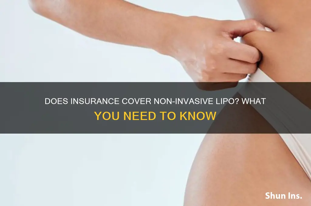 will my insurance company cover non invasive lipo